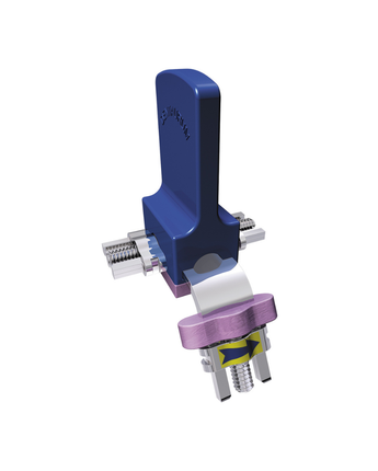 Dentaurum Three dimensional screw acc. to Steiner, 1st
