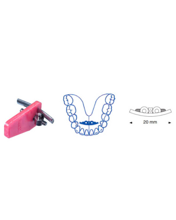 Leone® Expansionsskruv Mandubulär Bågskruv, 20mm