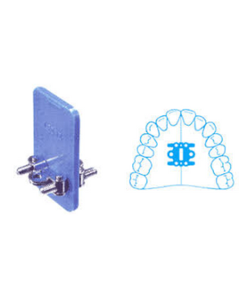 Leone® Expansionsskruv Bi-Fan-Type, 14mm