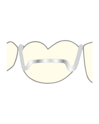 Scheu Adams klammer 10pack