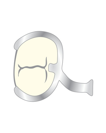 Scheu NK-klammer 0.8 mm 10pack