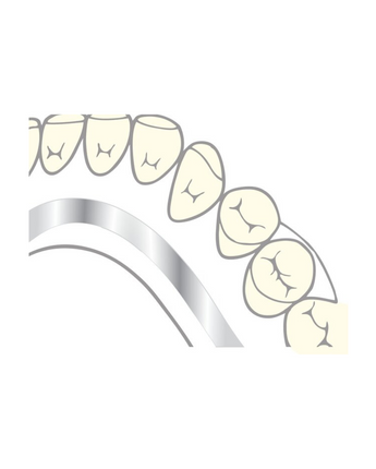 Scheu PROFI-bar 10pack