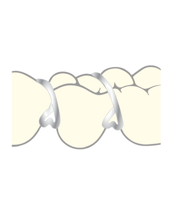 Scheu Triangel-klammer 10pack