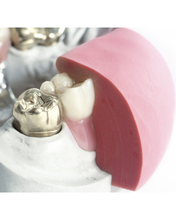 Dentona 1:1 gum 2x 5 kg