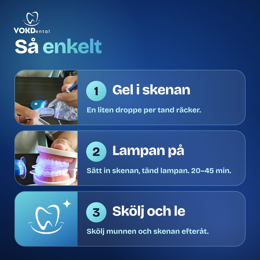 Så använder du tandblekningskitet i tre steg: gel i skenan, lampan på, skölj