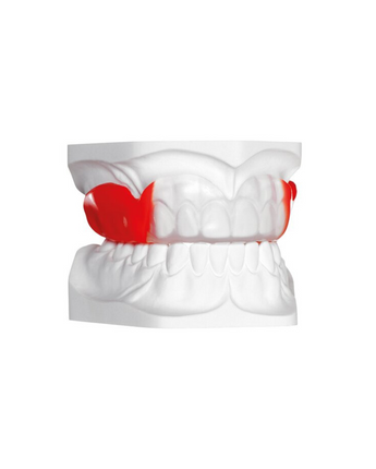 BIOPLAST® XTREME Röd rund 5.0x125 mm